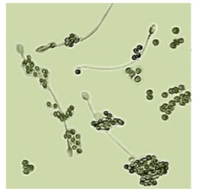IgAの抗体のコーティングの精子（3月）の決定のためのキット