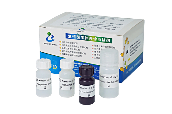 精子DNA断片化試験 精子染色体構造測定 SCSA