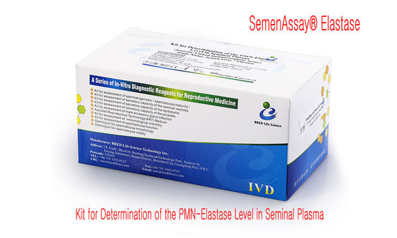 DNAの分裂のレベルの決定のための経済的な精液DNAの分裂テスト キット--精液のクロマチンの分散方法