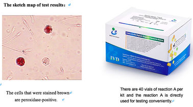 男性の生殖管の伝染のスクリーニングのための精液のサンプルの白血球テスト キット 40T/Kit